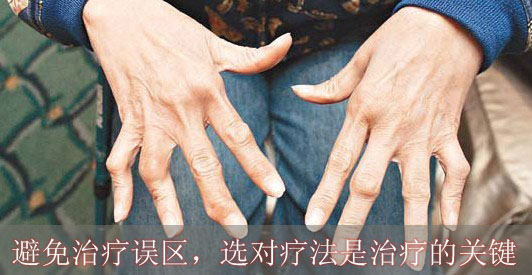 类风湿性关节炎为什么难治