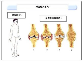 緢ʪԹؽףӦעʲô?