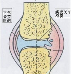 ĤҪ֢״뱣