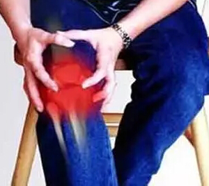 类风湿关节炎的治疗方法