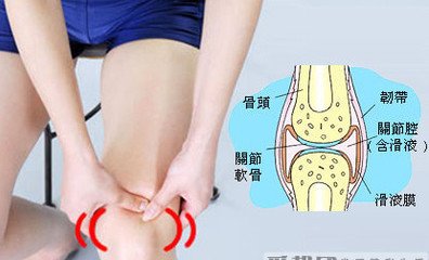 膝关节滑膜炎的症状